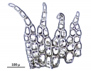 Neolepidozia heterotexta