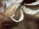 Plagiochila bicornuta