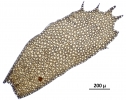 Plagiochila bicornuta
