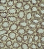 Plagiochila bicornuta