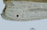 Hypnodendron camptotheca