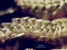 Tetracymbaliella comptonii