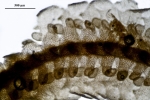 Tetracymbaliella comptonii