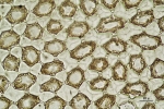 Tetracymbaliella comptonii