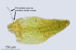 Molendoa hornschuchiana
