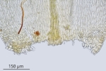 Brachytheciastrum trachypodium