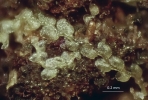 Metalejeunea cucullata