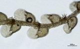 Metalejeunea cucullata
