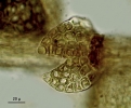 Metalejeunea cucullata
