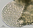 Metalejeunea cucullata