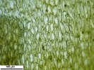 Scorpiurium circinatum