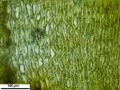 Scorpiurium circinatum