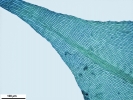 Scorpiurium circinatum