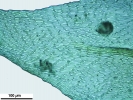Scorpiurium circinatum