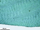 Scorpiurium circinatum