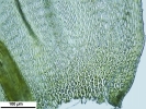 Scorpiurium circinatum