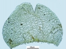 Scorpiurium circinatum