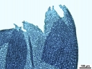 Lophozia guttulata