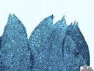 Lophozia guttulata