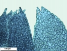 Lophozia guttulata