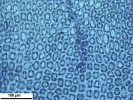 Lophozia guttulata