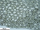 Lophozia guttulata