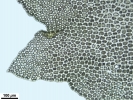 Lophozia guttulata