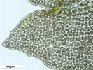 Lophozia guttulata