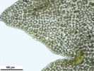 Lophozia guttulata