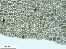Lophozia guttulata