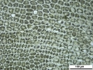 Lophozia guttulata