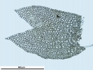 Lophozia guttulata