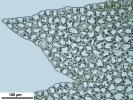 Lophozia guttulata