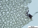 Lophozia guttulata
