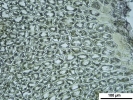 Lophozia guttulata