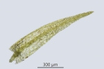 Rhynchostegiella teneriffae
