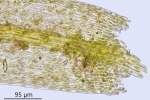 Rhynchostegiella teneriffae