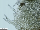 Schistochilopsis incisa