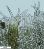 Schistochilopsis incisa
