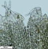 Schistochilopsis incisa