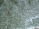 Schistochilopsis incisa