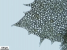 Schistochilopsis incisa