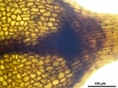 Seligeria carniolica