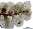 Cololejeunea sophiana