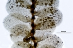 Cololejeunea sophiana