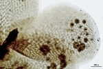 Cololejeunea sophiana