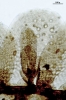 Cololejeunea sophiana