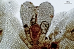 Cololejeunea sophiana