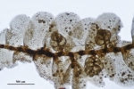 Cololejeunea sophiana