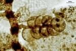 Cololejeunea sophiana
